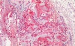 Osteocalcin Antibody, Novus Biologicals 50 &mu;g | Buy Online | Novus Biologicals | Fisher Scientific